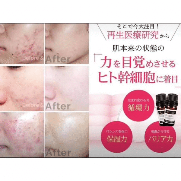 HSCM100-SF HUMAN STEM CELL CULTURE SUPERNATANT