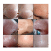 REMOVE BLACKHEADS DESINCRUSTATION SOLUTION (400ML)