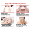 REMOVE BLACKHEADS DESINCRUSTATION SOLUTION (400ML)